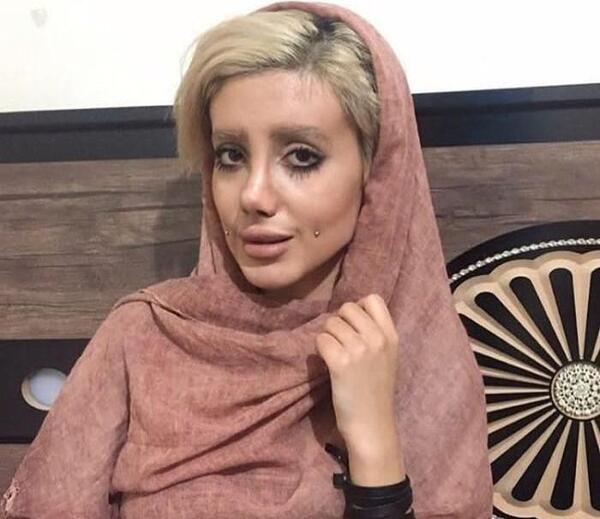 عکس سحر تبر قبل از عمل در اینستا
