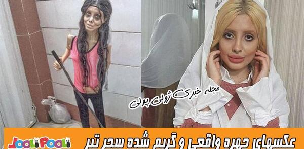 عکس سحر تبر قبل از عمل در اینستا