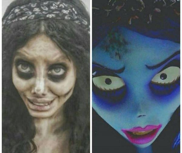 عکس سحر تبر قبل از عمل در اینستا