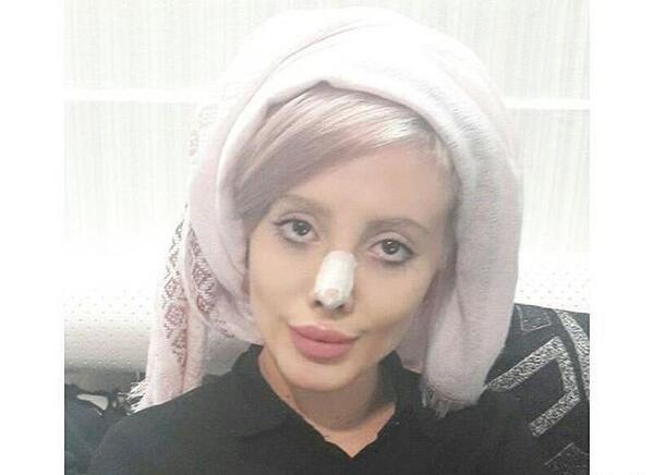 عکس سحر تبر قبل از عمل در اینستا