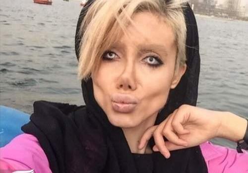 عکس سحر تبر قبل از عمل در اینستا