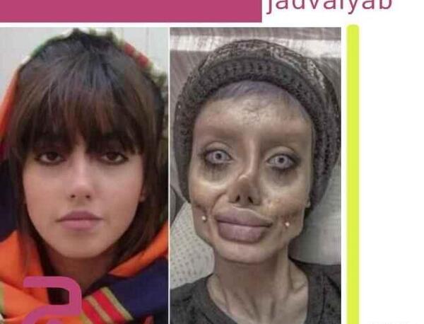 عکس سحر تبر قبل از عمل در اینستا