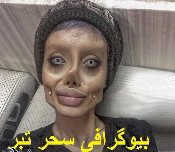 عکس سحر تبر قبل از عمل در اینستا