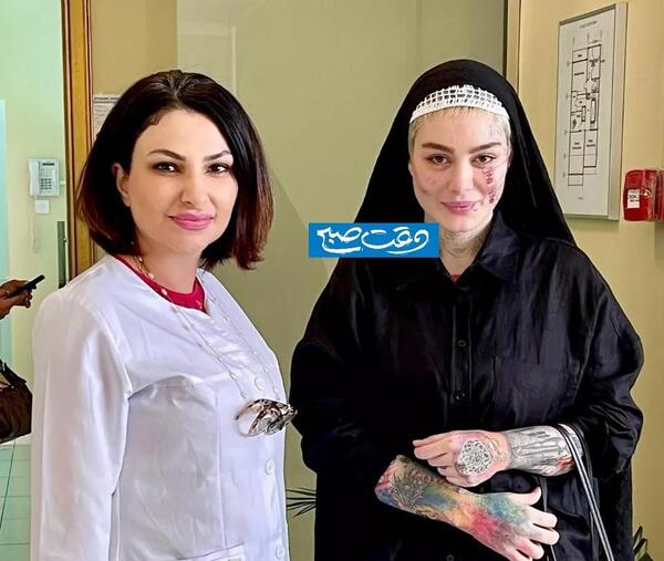 عکس قبل و بعد از عمل سحر قریشی