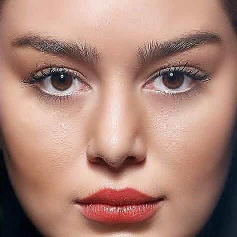 عکس قبل و بعد از عمل سحر قریشی