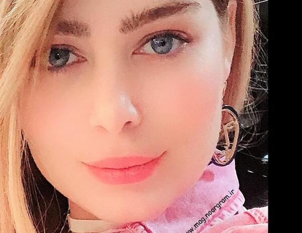 عکس قبل و بعد از عمل سحر قریشی