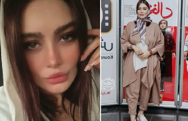 عکس قبل و بعد از عمل سحر قریشی