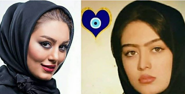عکس قبل عمل زیبایی سحر قریشی
