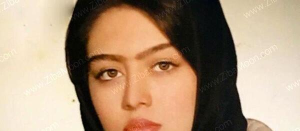 عکس قبل عمل بینی سحر قریشی