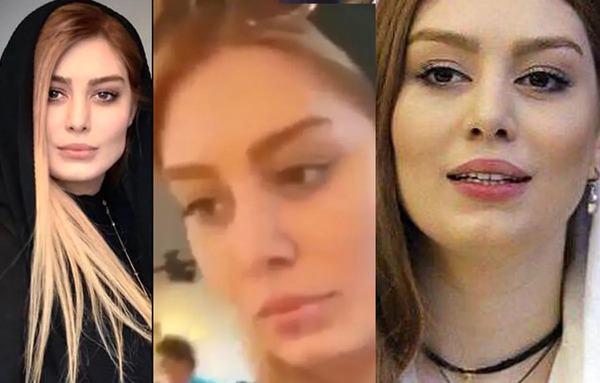 عکس قبل عمل بینی سحر قریشی