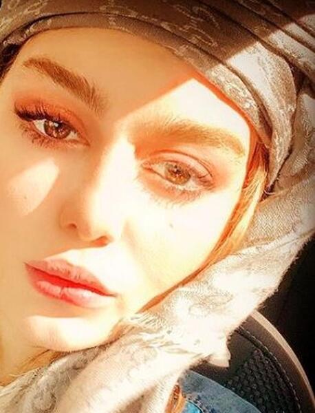 عکس قبل عمل بینی سحر قریشی