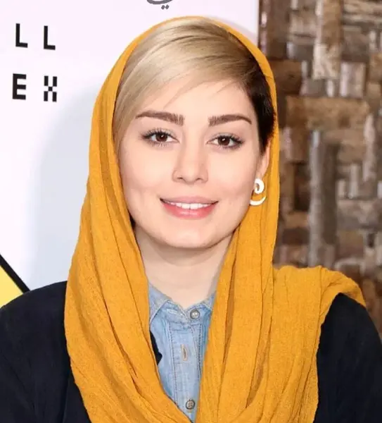 عکس قبل عمل بینی سحر قریشی