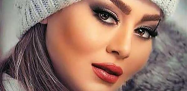 عکس قبل عمل بینی سحر قریشی