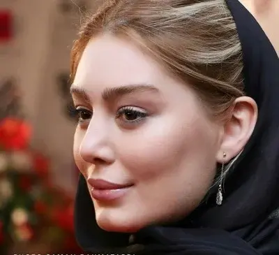 عکس قبل عمل بینی سحر قریشی