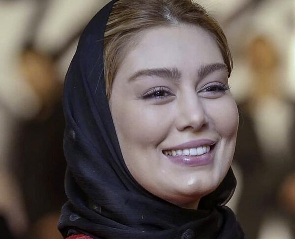 عکس های قبل عمل سحر قریشی