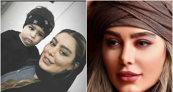 عکس های قبل عمل سحر قریشی