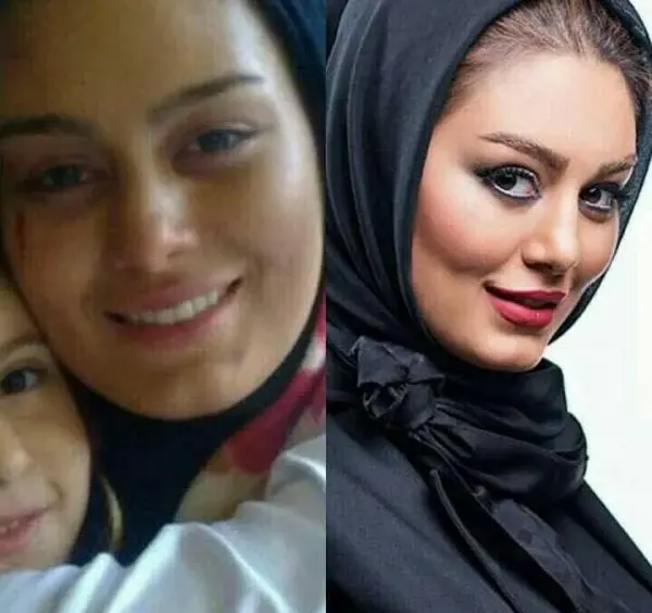 عکس های قبل عمل سحر قریشی