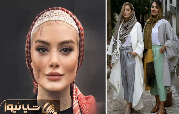 عکس بازیگر سحر قریشی قبل از عمل