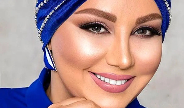 عکس قبل از عمل بینی بهنوش بختیاری