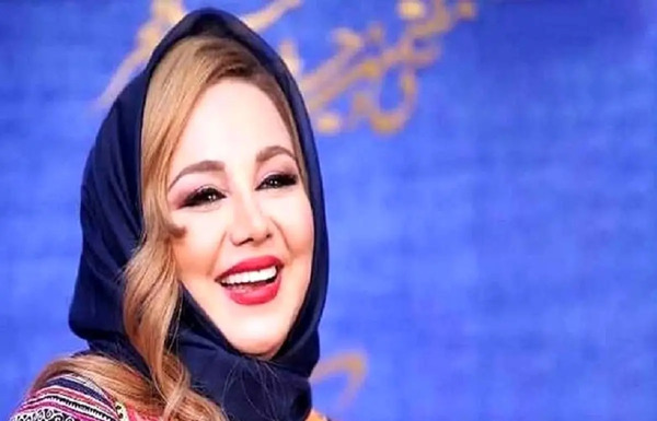 عکس قبل از عمل بینی بهنوش بختیاری