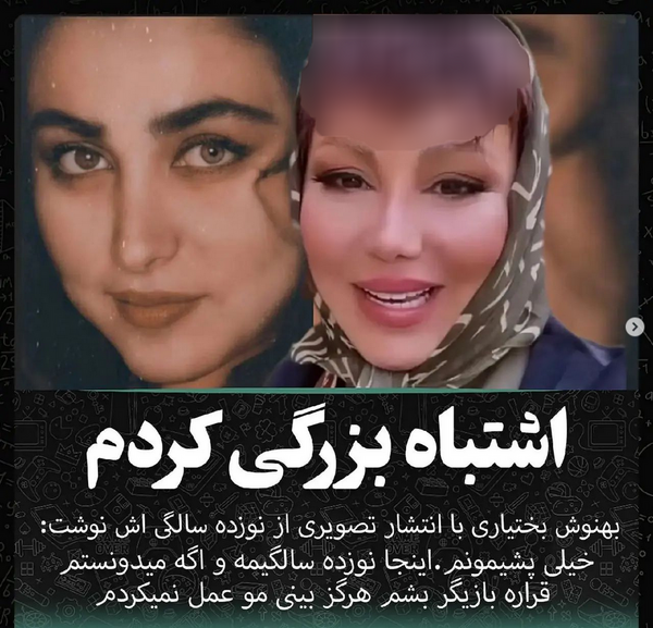 عکس قبل از عمل بینی بهنوش بختیاری