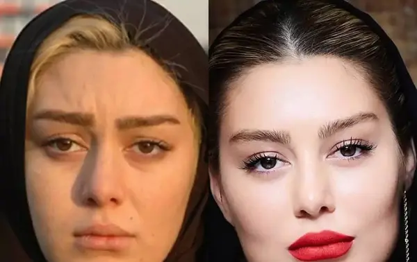 عکس قبل ارایش