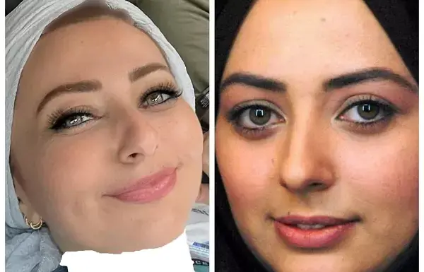عکس قبل ارایش