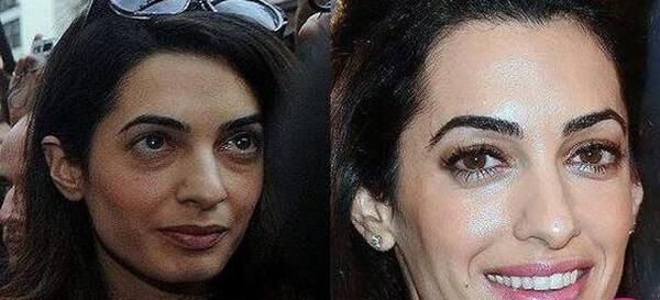 عکس انجلینا جولی قبل از عمل بینی