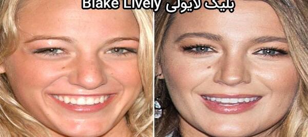 عکس انجلینا جولی قبل از عمل بینی