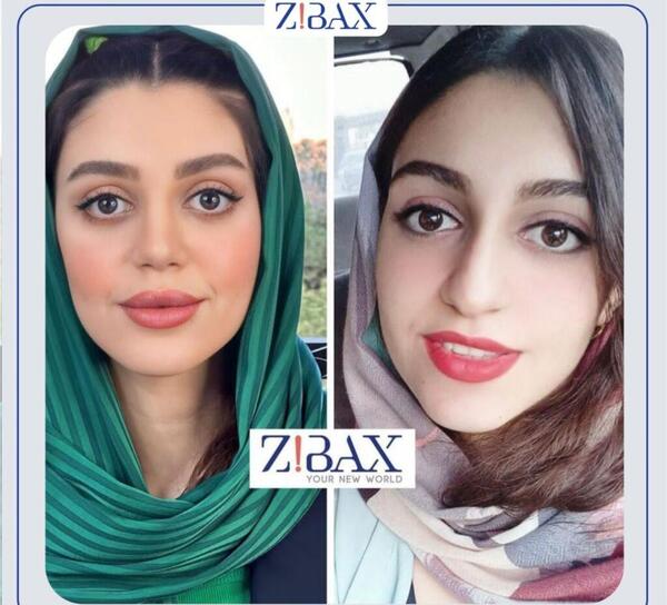 عکس قبل و بعد عمل بینی استخوانی