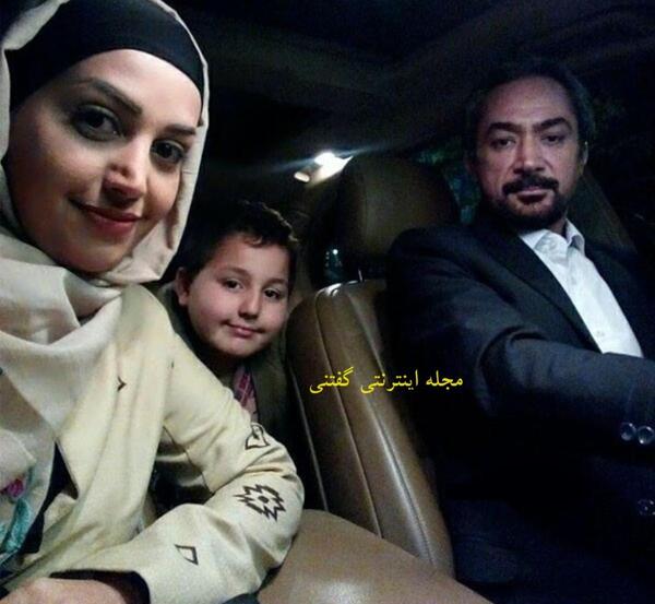 عکس قبل و بعد عمل بینی محمد حاتمی