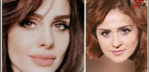 عکس قبل و بعد عمل بینی محمد حاتمی