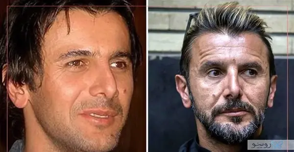 عکس قبل و بعد عمل بینی محمد حاتمی