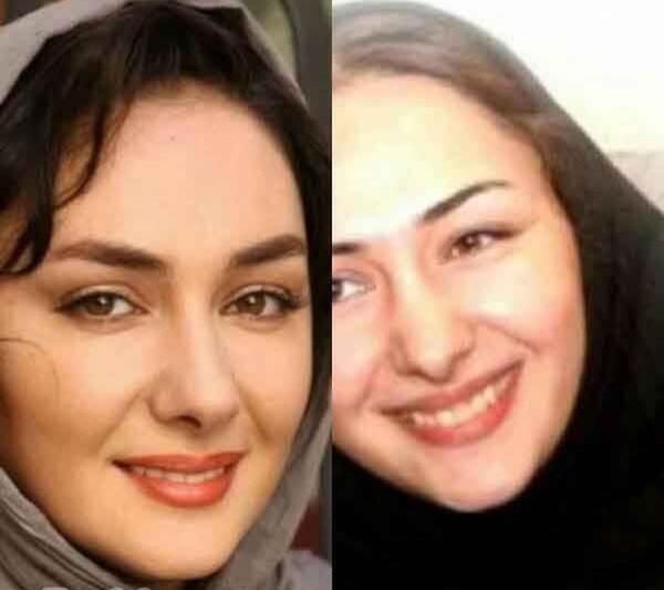 عکس قبل و بعد عمل بینی محمد حاتمی
