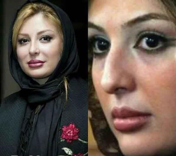 عکس قبل و بعد عمل بینی محمد حاتمی