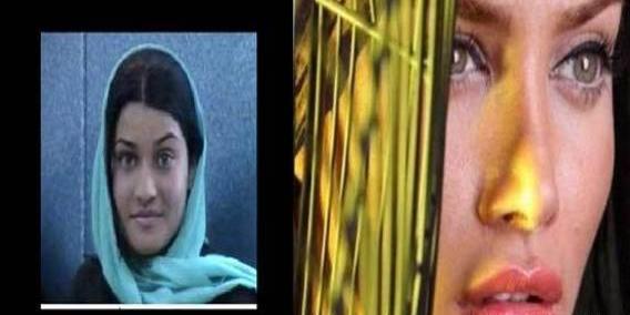 عکس قبل و بعد عمل بینی بازیگران