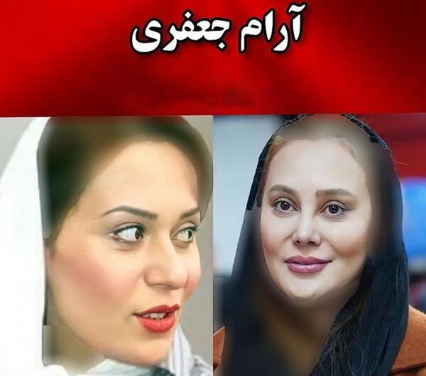 عکس قبل و بعد عمل بینی بازیگران