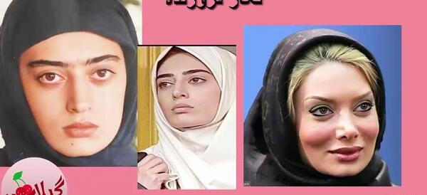 عکس قبل و بعد عمل بینی بازیگران