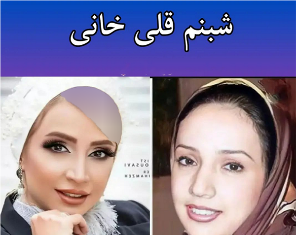 عکس قبل و بعد عمل بینی بازیگران