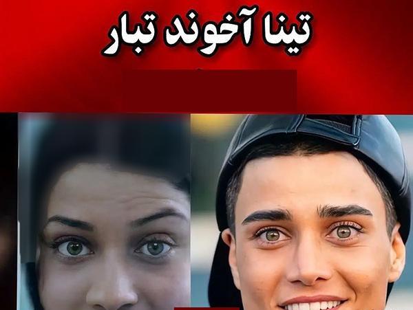عکس قبل و بعد عمل بینی بازیگران