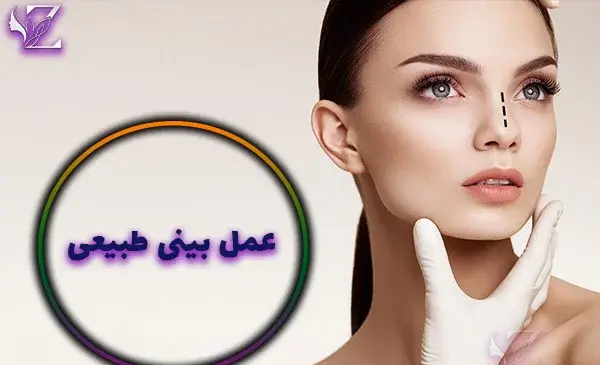 عکس قبل و بعد عمل بینی طبیعی