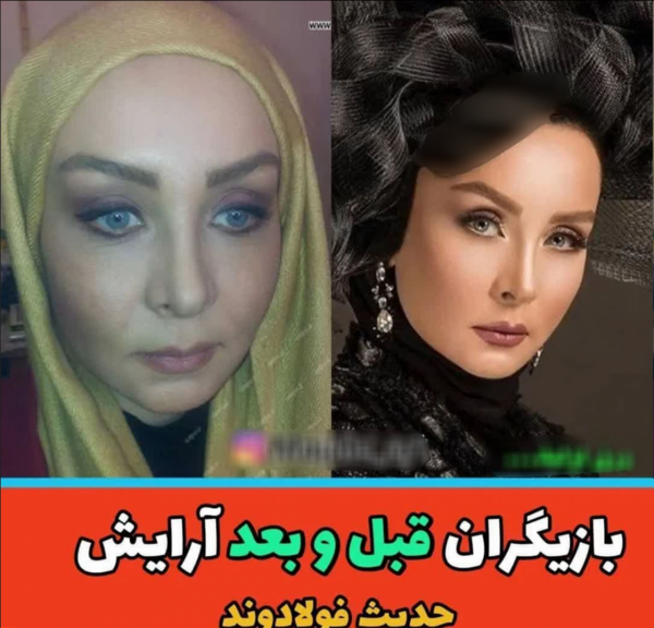 عکس قبل و بعد عروس
