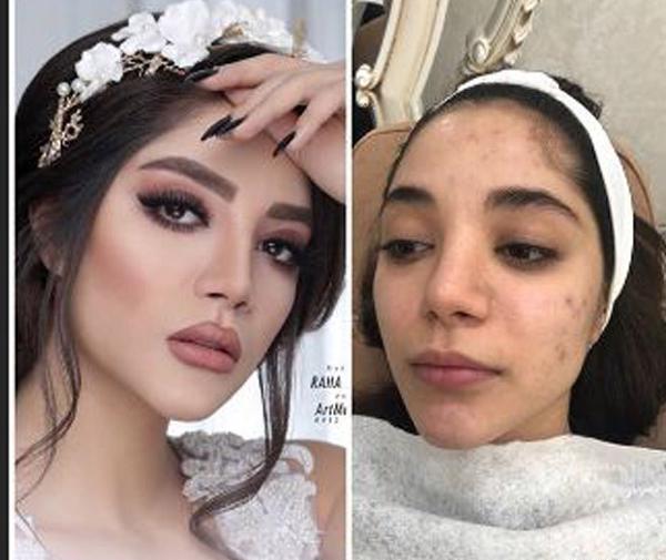 عکس قبل و بعد عروس