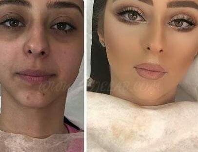 عکس قبل و بعد میکاپ عروس