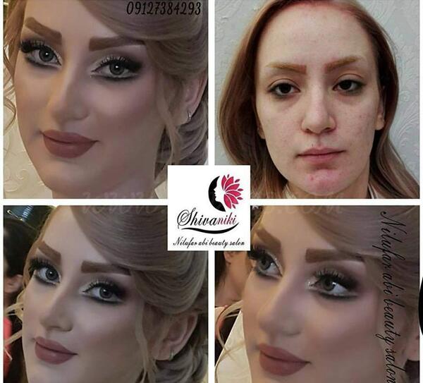 عکس قبل و بعد از عروس