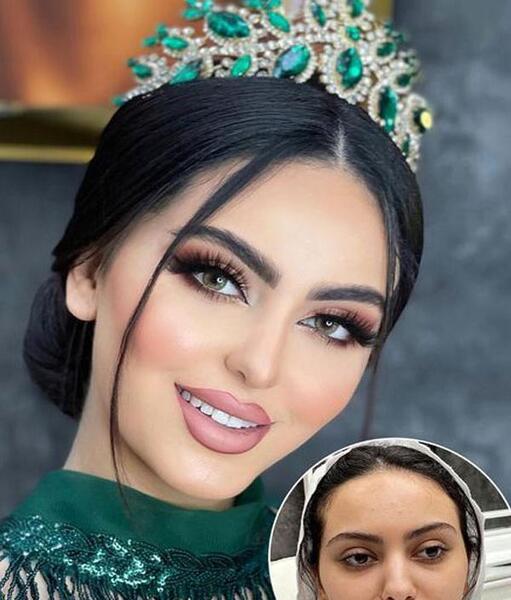 عکس قبل و بعد از عروس