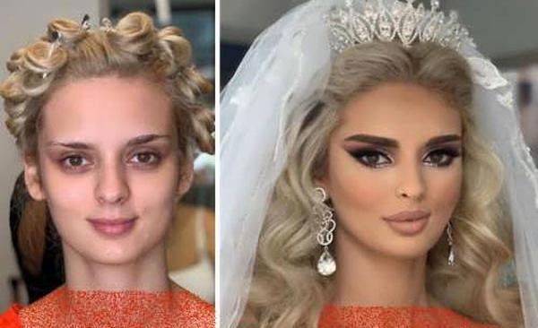 عکس قبل و بعد از عروس