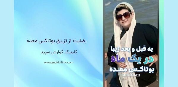 عکس قبل و بعد بوتاکس معده