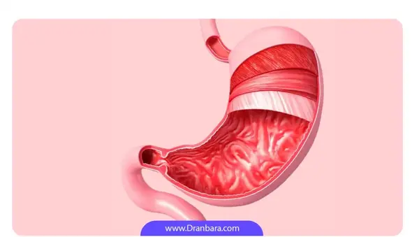 عکس قبل و بعد بوتاکس معده