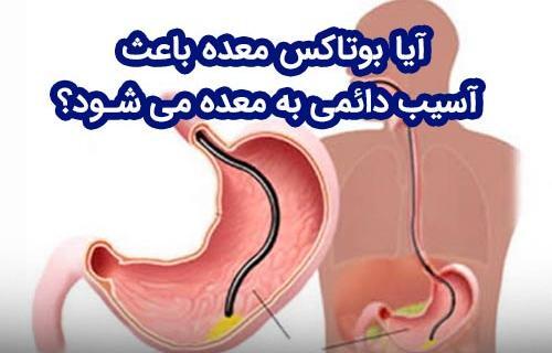 عکس قبل و بعد بوتاکس معده